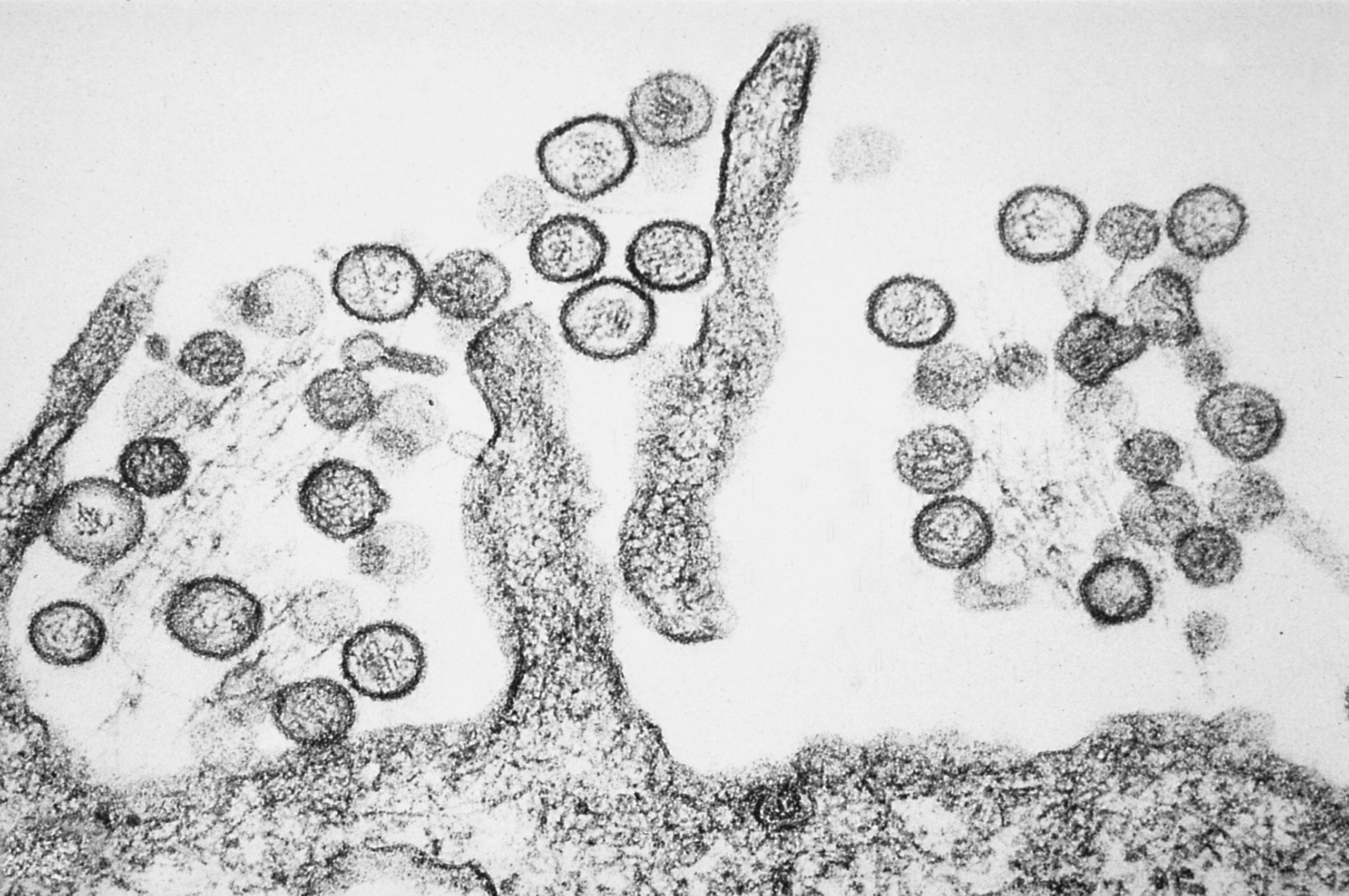 Sin Nombre hantavirus particles under transmission electron microscope